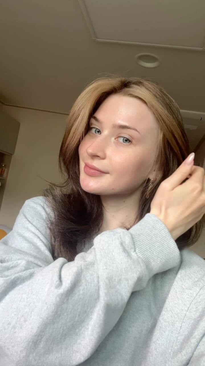 Sofiia S. — Botox